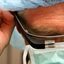 Médico faz Cirurgia com o Google Glass no Brasil